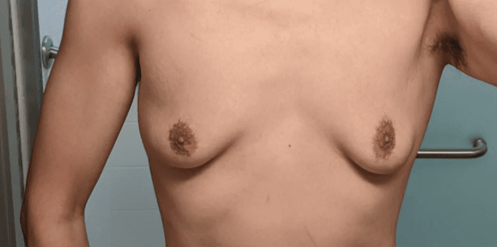 Chest at the start of a body-recomposition effort.