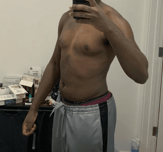 Same chest eight months later, mostly resolved.